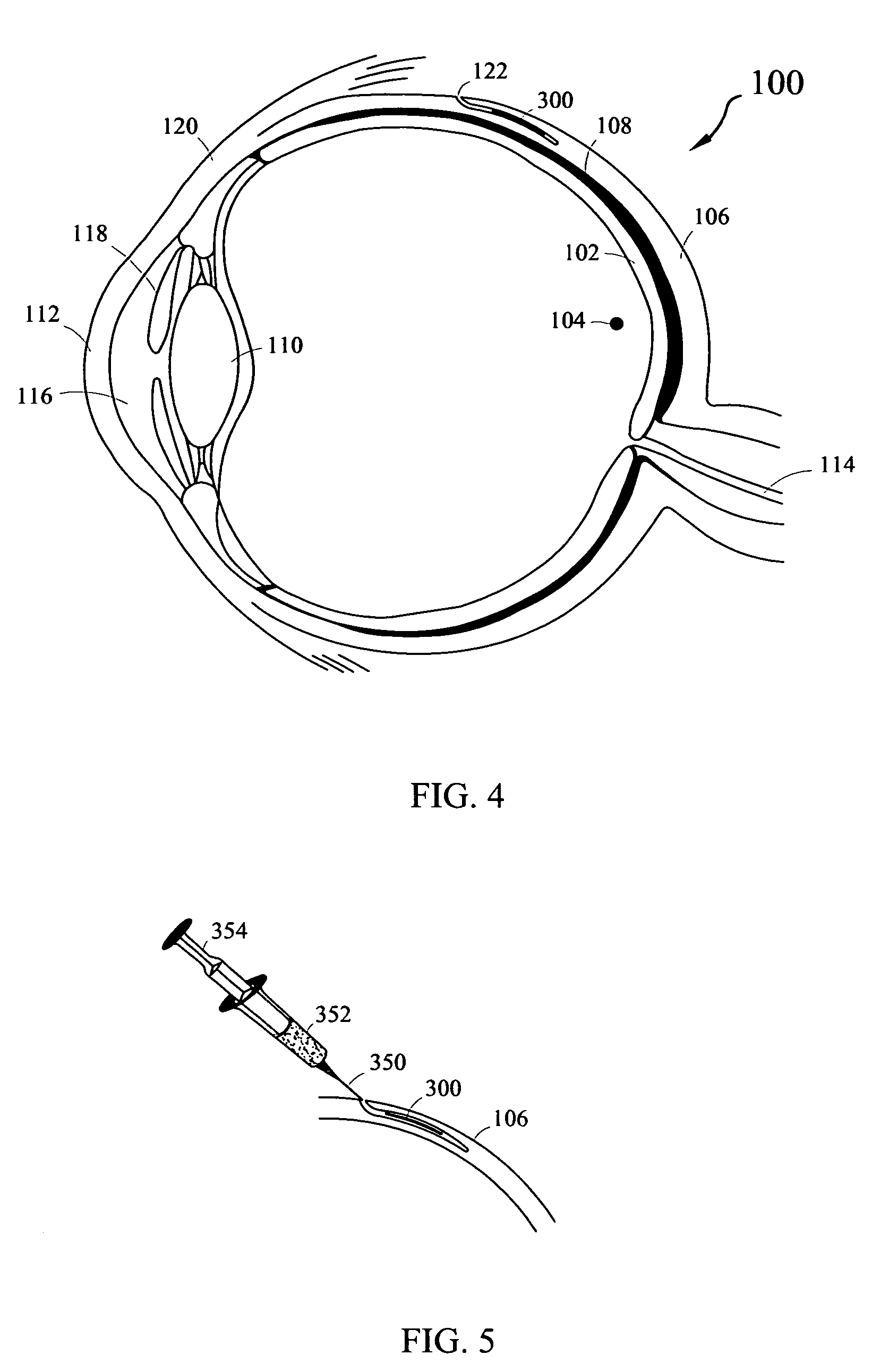 System for maintaining normal health of retinal cells and promoting regeneration of retinal cells