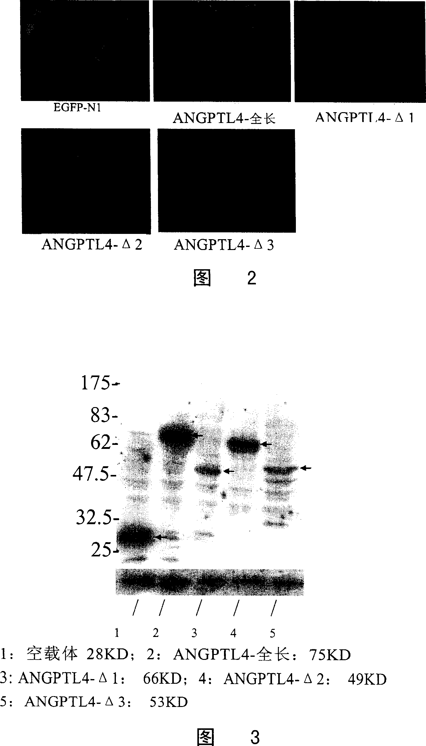 ANGPTL4 deletion mutant and application thereof