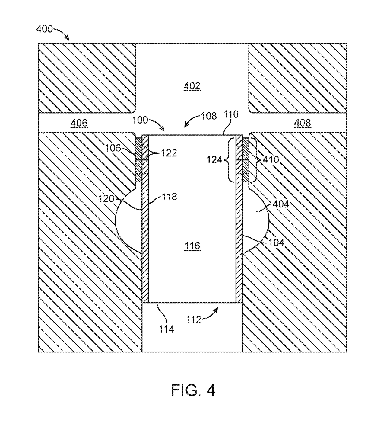 Stent graft with external scaffolding and method