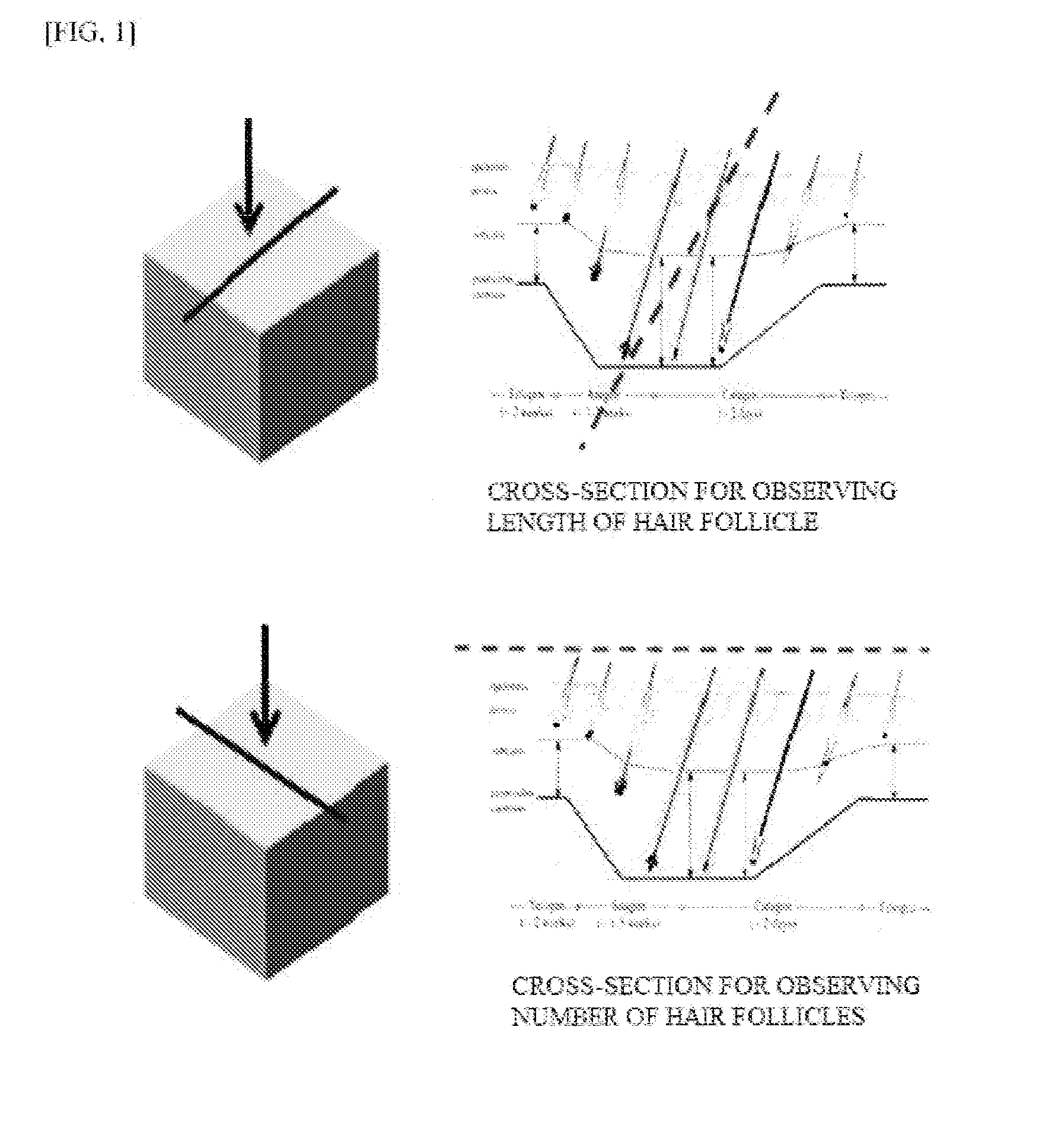 Capability of small-sized stem cells to stimulate hair growth and use thereof