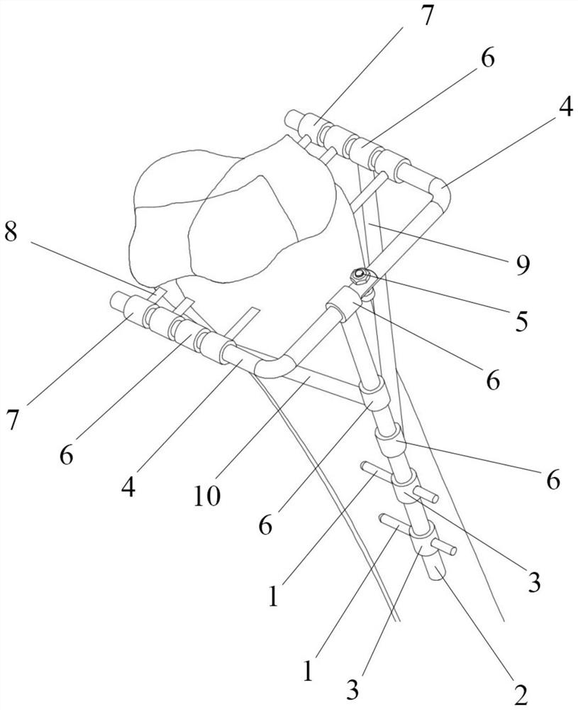 Non-transarticular external fixator for treating distal radius fracture