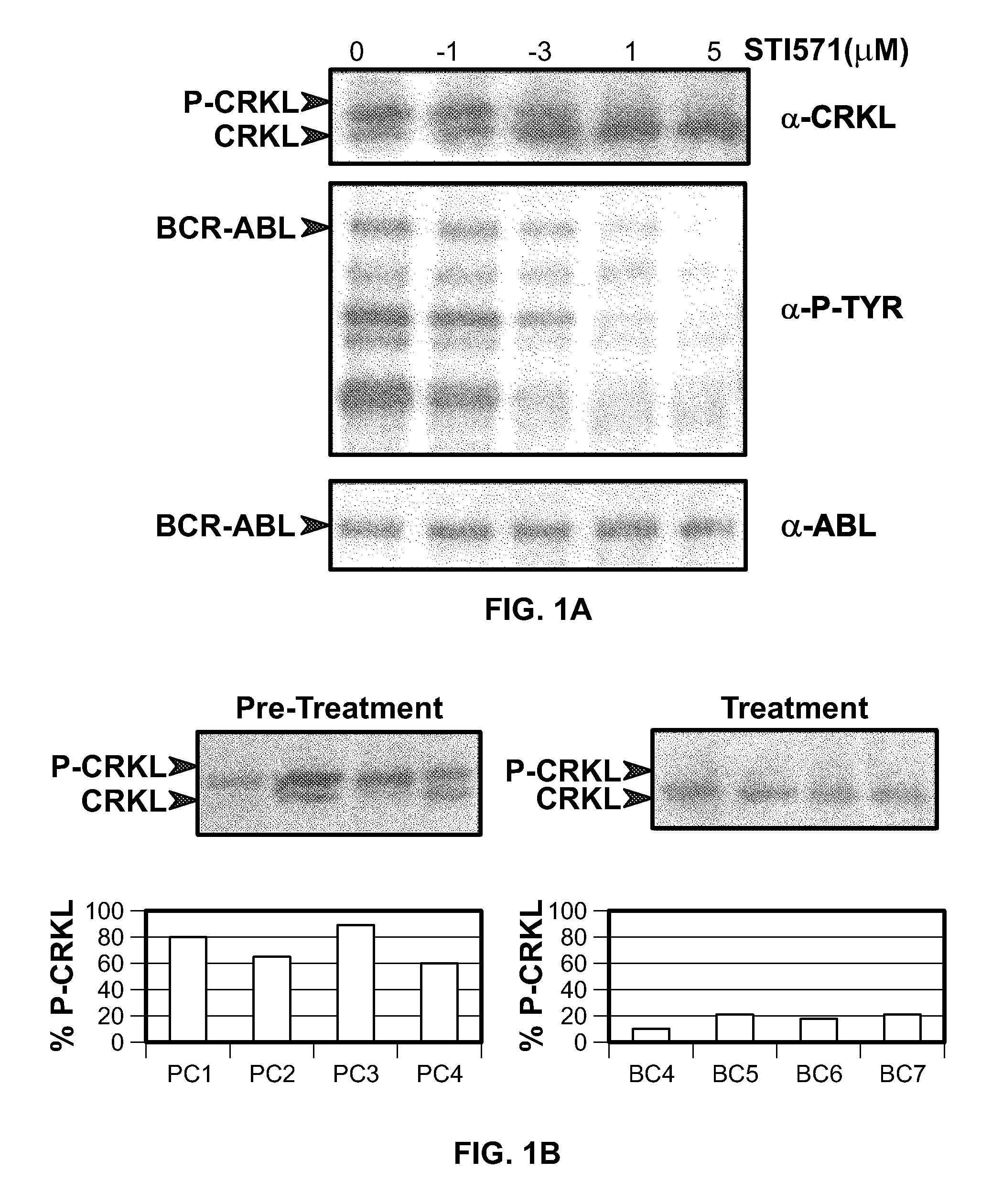 Mutations in the BCR-ABL tyrosine kinase associated with resistance to STI-571