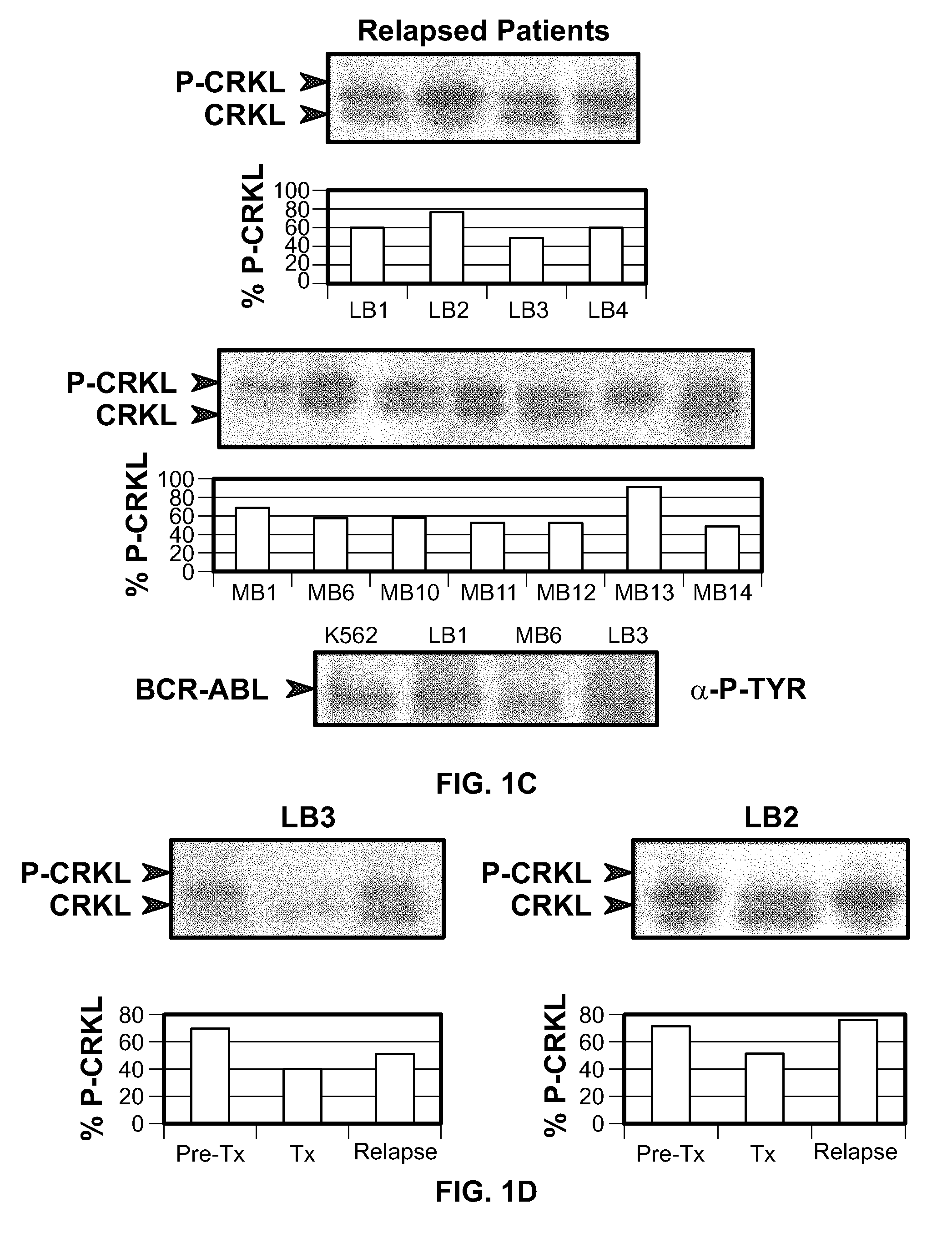 Mutations in the BCR-ABL tyrosine kinase associated with resistance to STI-571