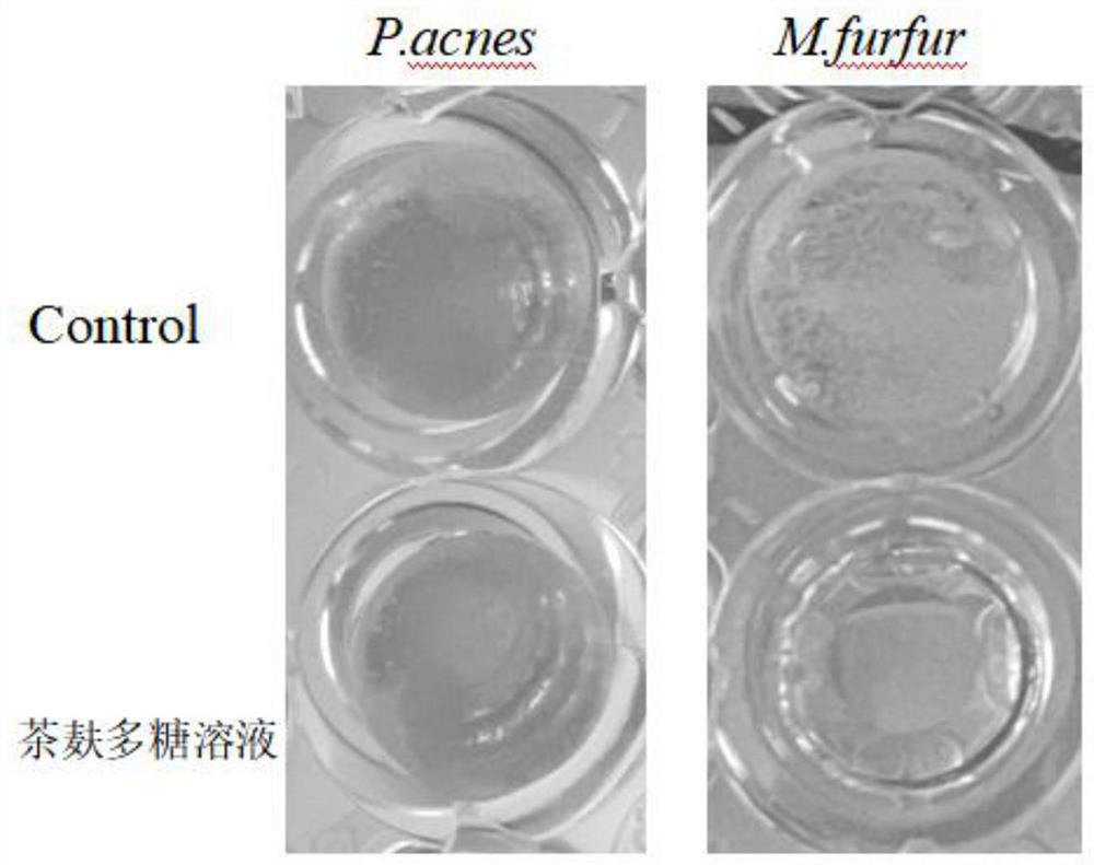 Plant extract composition with multi-target scalp oil control and dandruff removal effects, preparation method of plant extract composition and scalp care composition