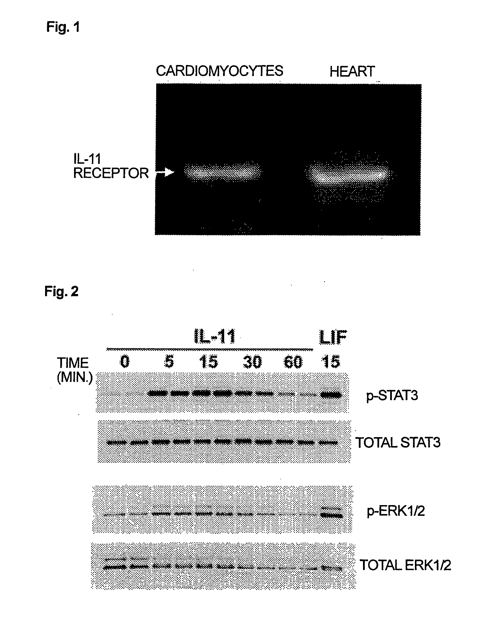 Use of interleukin-11 as therapeutic agent for heart disease