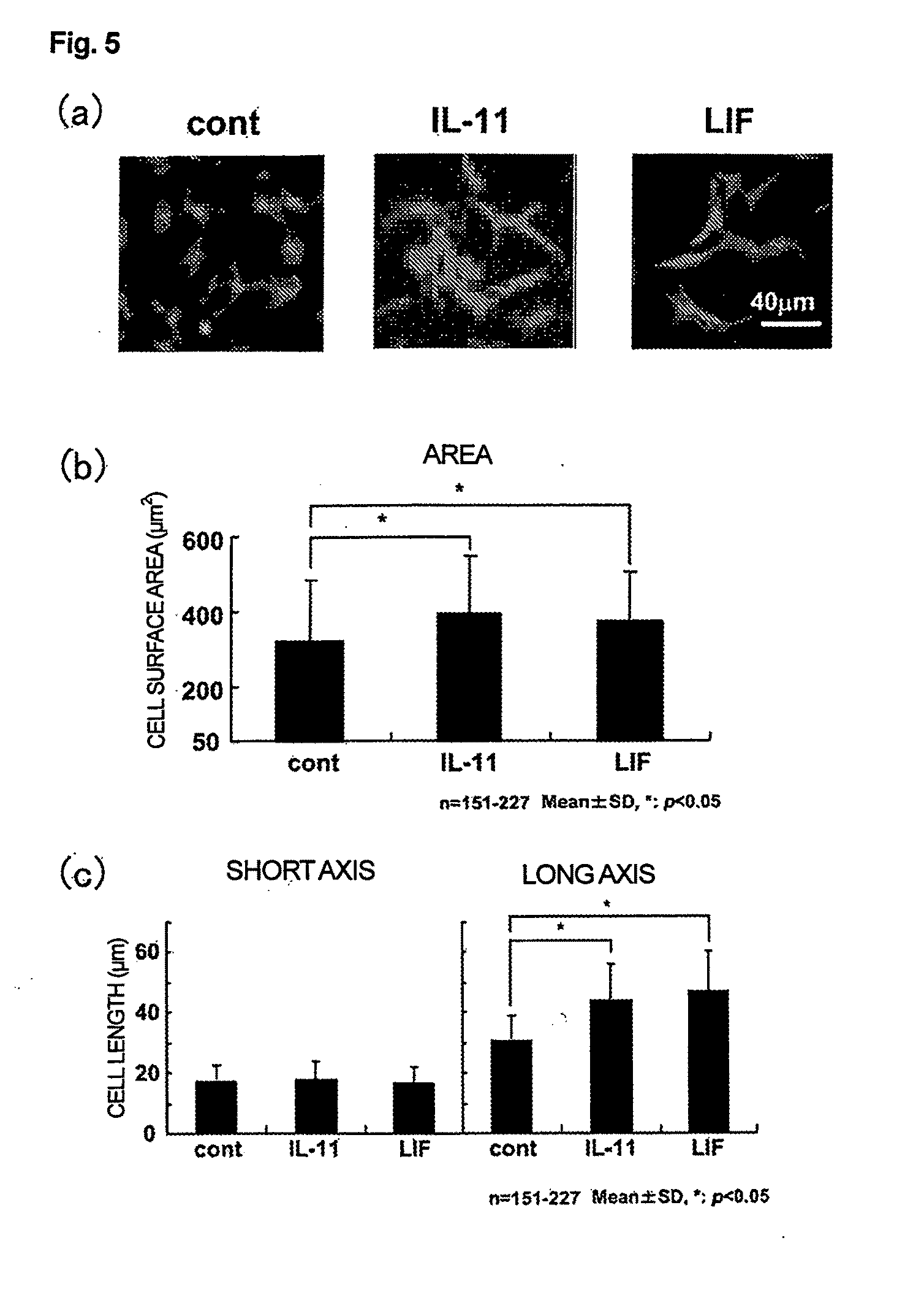 Use of interleukin-11 as therapeutic agent for heart disease