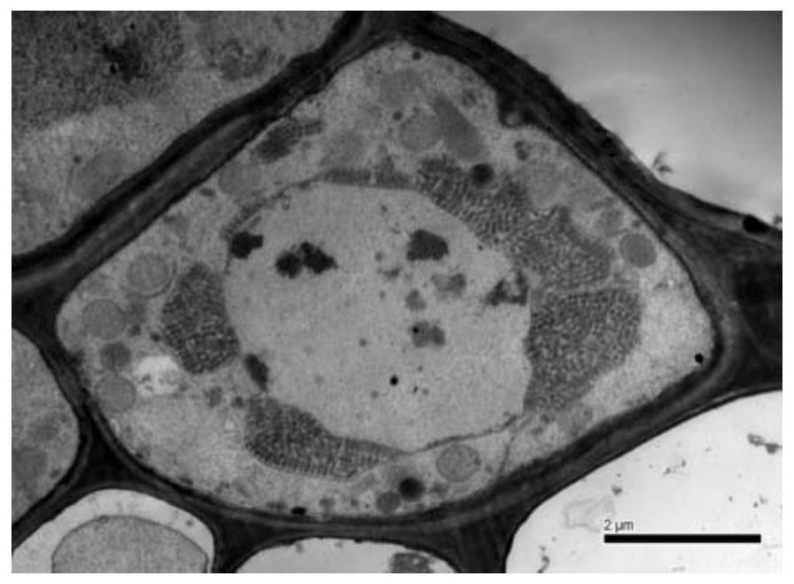 Wheat yellow streak virus and its nash detection method and detection kit