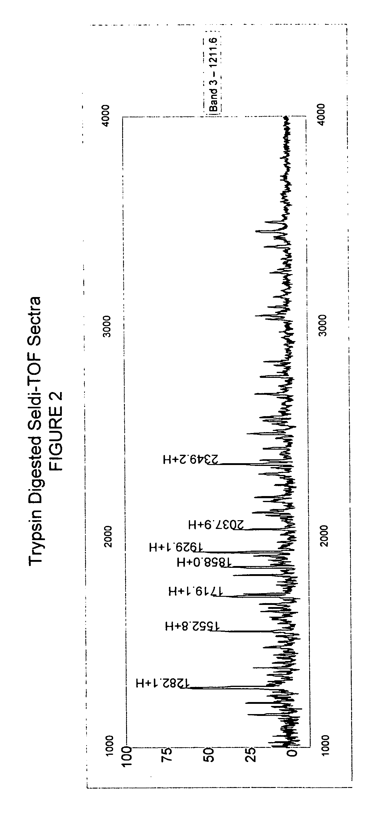 Inter-alpha trypsin inhibitor biopolymer marker indicative of insulin resistance