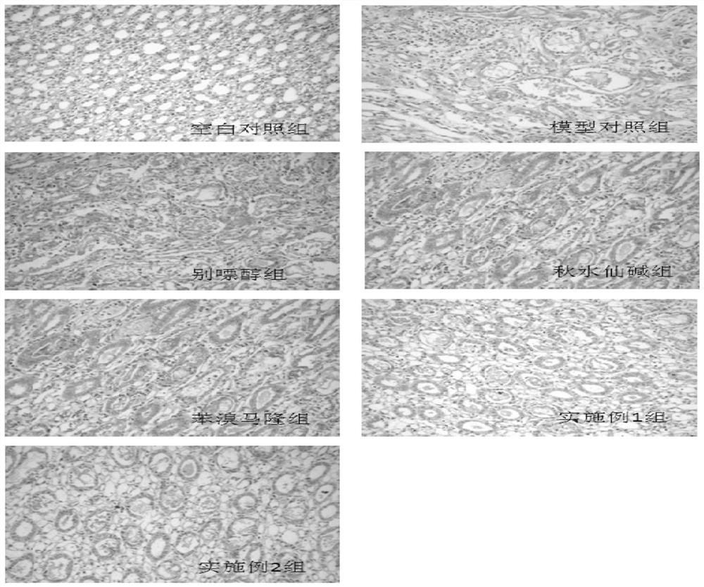 A compound honeysuckle with antidepressant effect and its preparation method and application