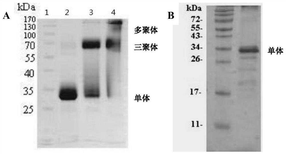 Recombinant adiponectin antigen, antibody and adiponectin nano-latex enhanced immunoturbidimetric assay kit