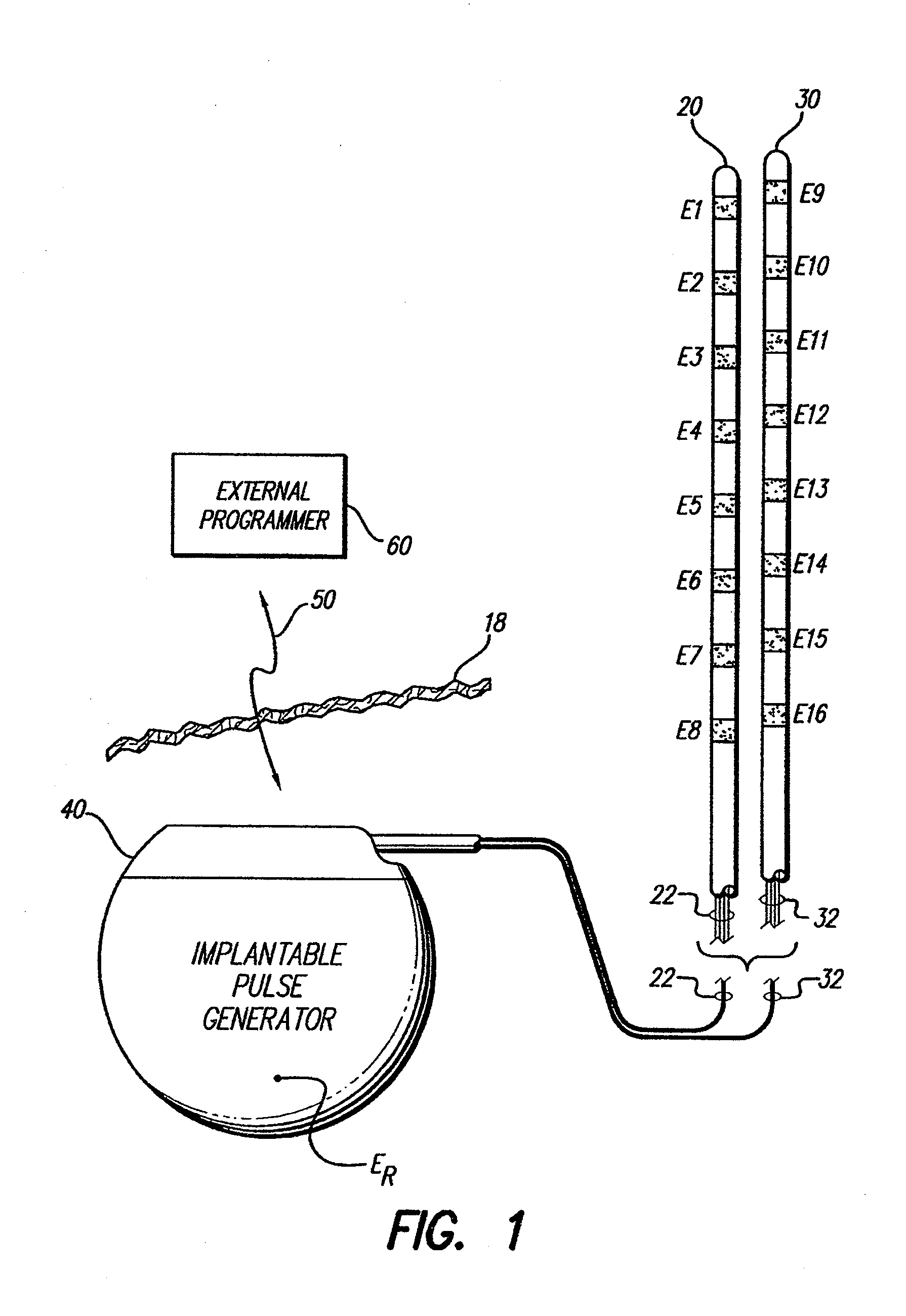 Apparatus and method for determining the relative position and orientation of neurostimulation leads