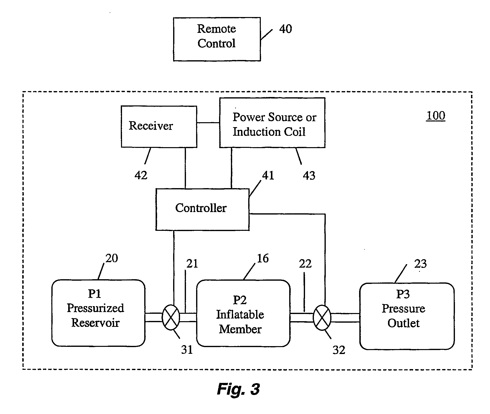 Remotely adjustable gastric banding device and method