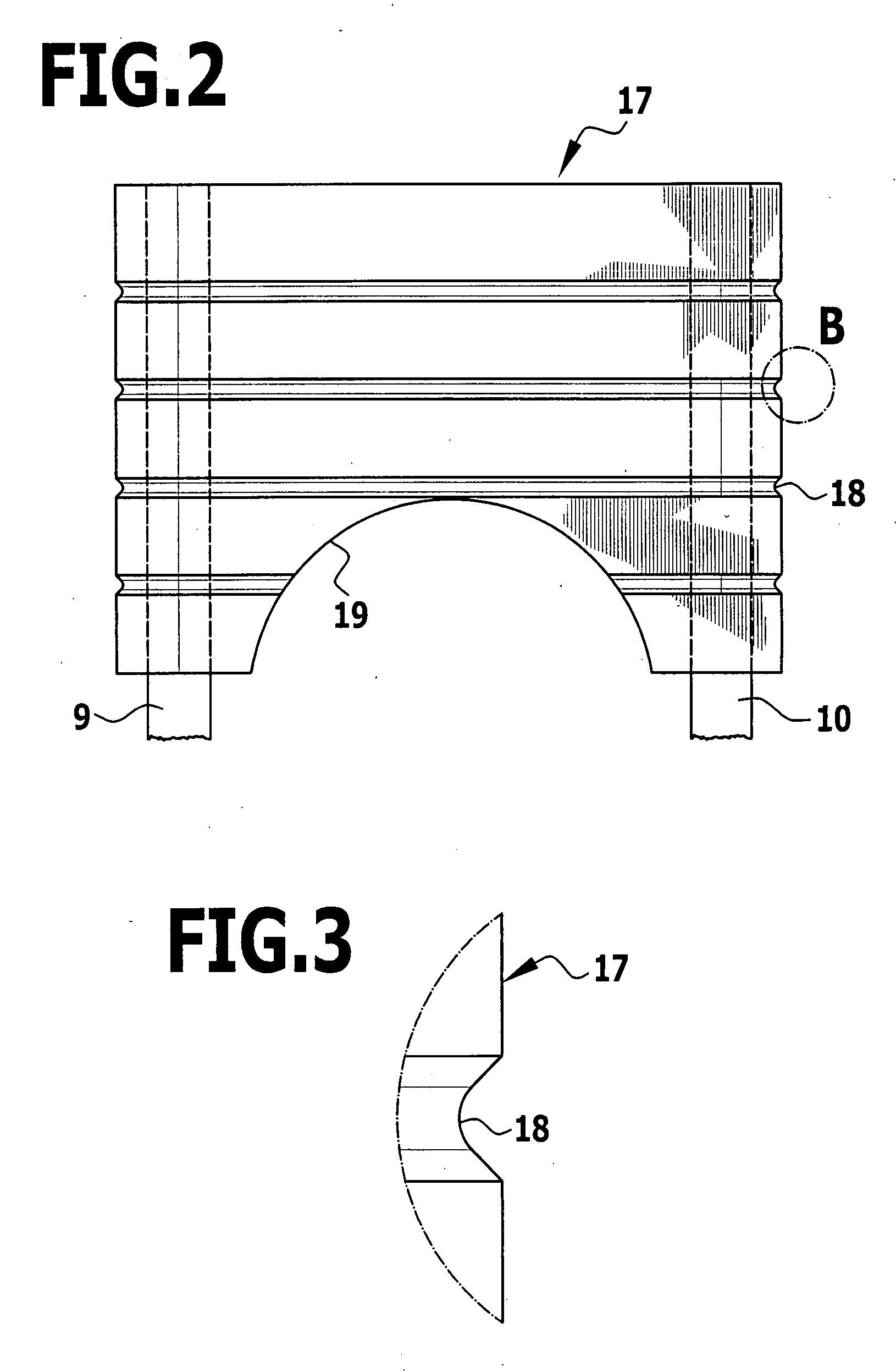 Implant for fixing two bone parts to be connected to each other