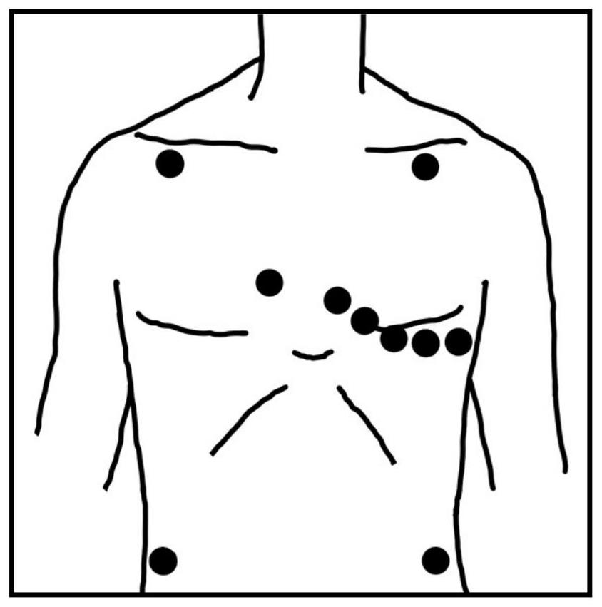 12-lead electrocardio-electrode plate wearing auxiliary examination method based on image target detection