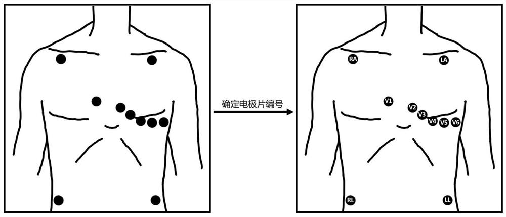 12-lead electrocardio-electrode plate wearing auxiliary examination method based on image target detection