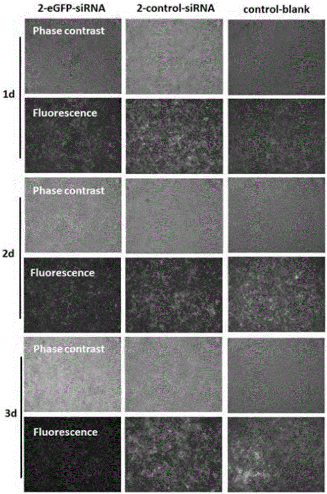 Protein or polypeptide drug-loaded tissue adhesive film and preparation method thereof