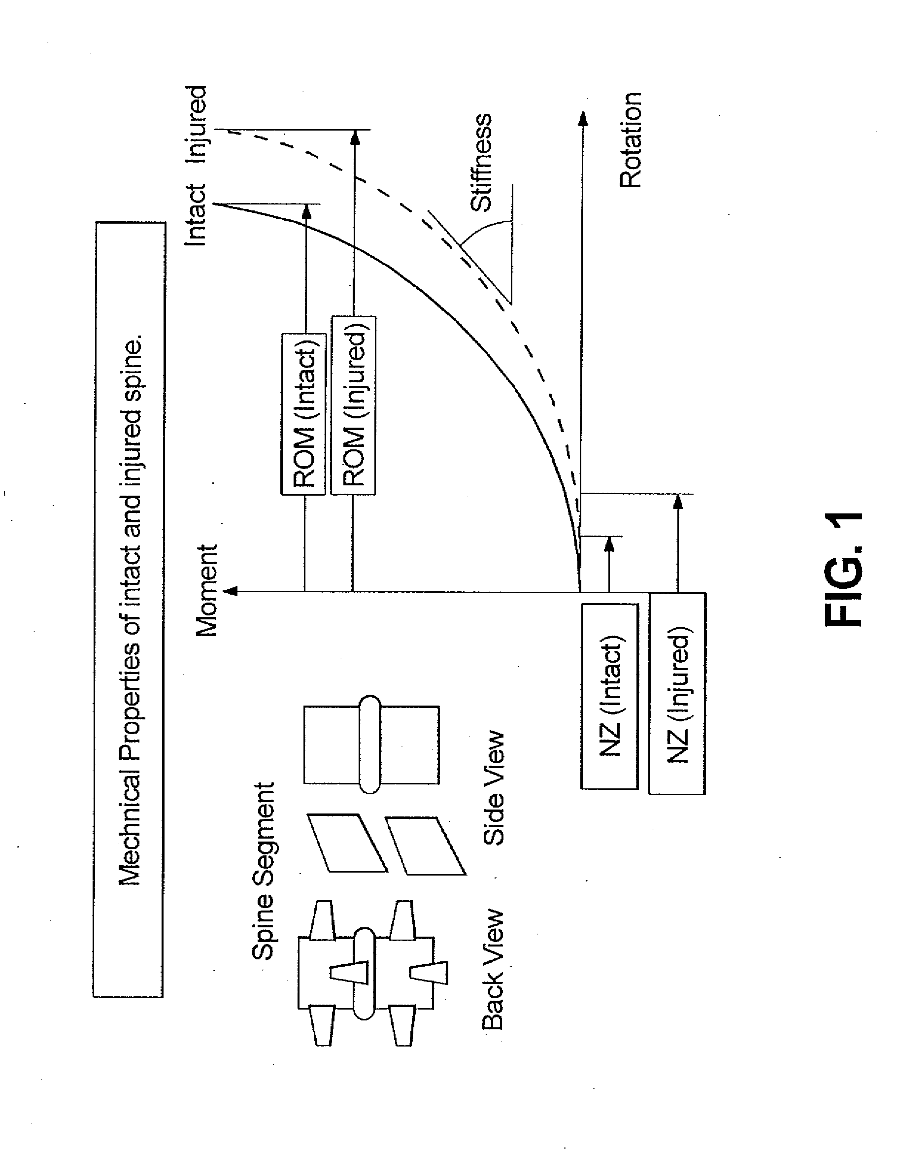 Method for stabilizing a spinal segment