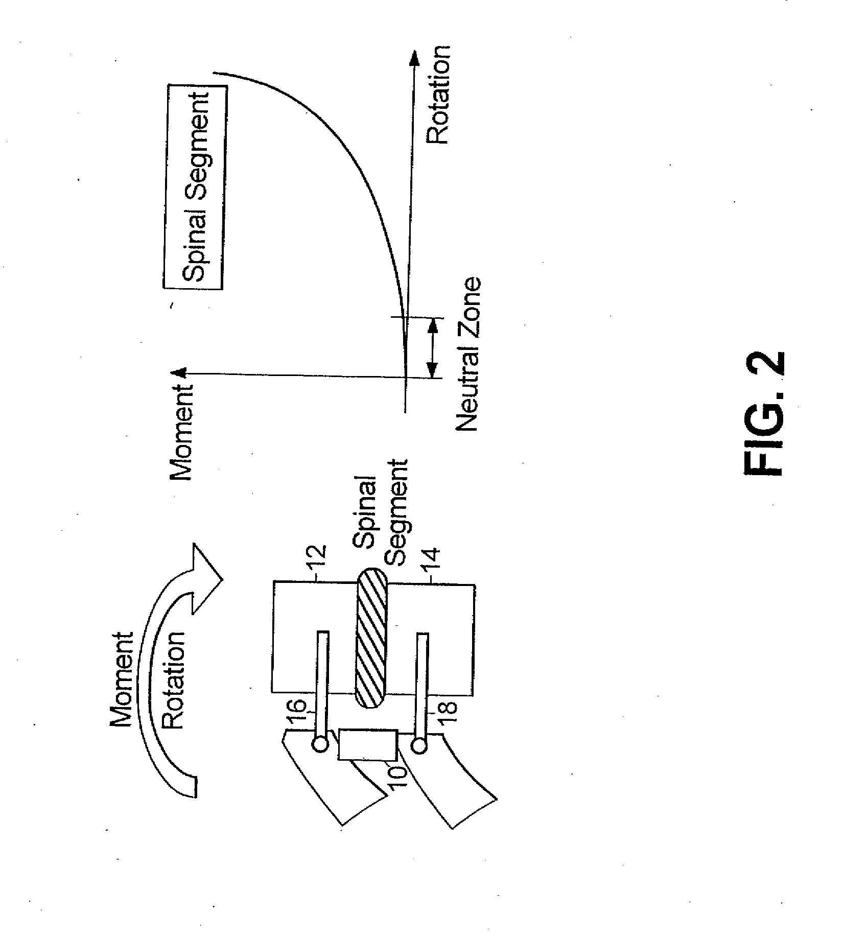 Method for stabilizing a spinal segment
