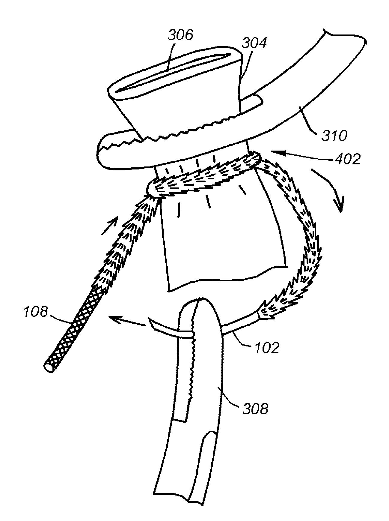 Locking suture