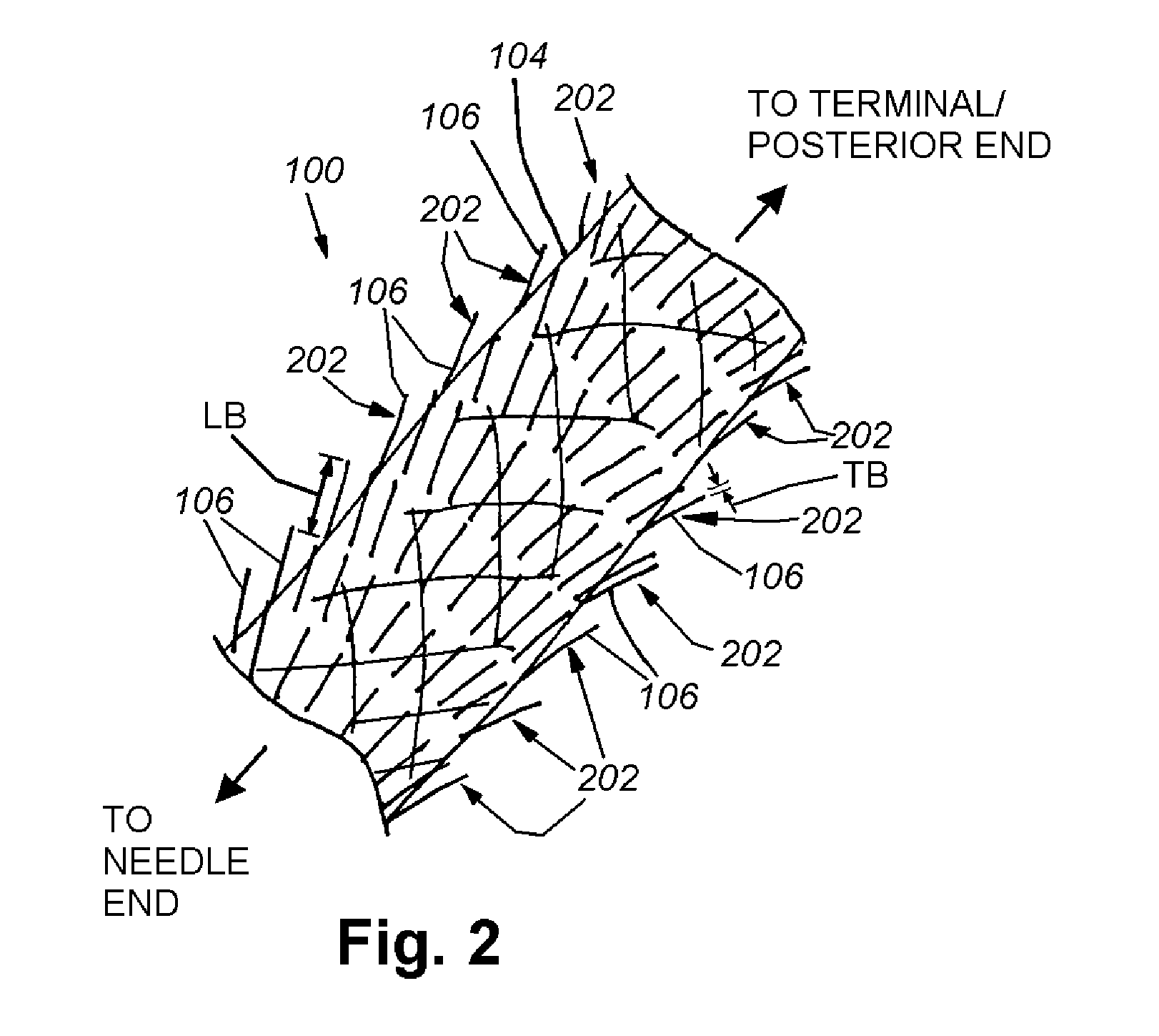 Locking suture