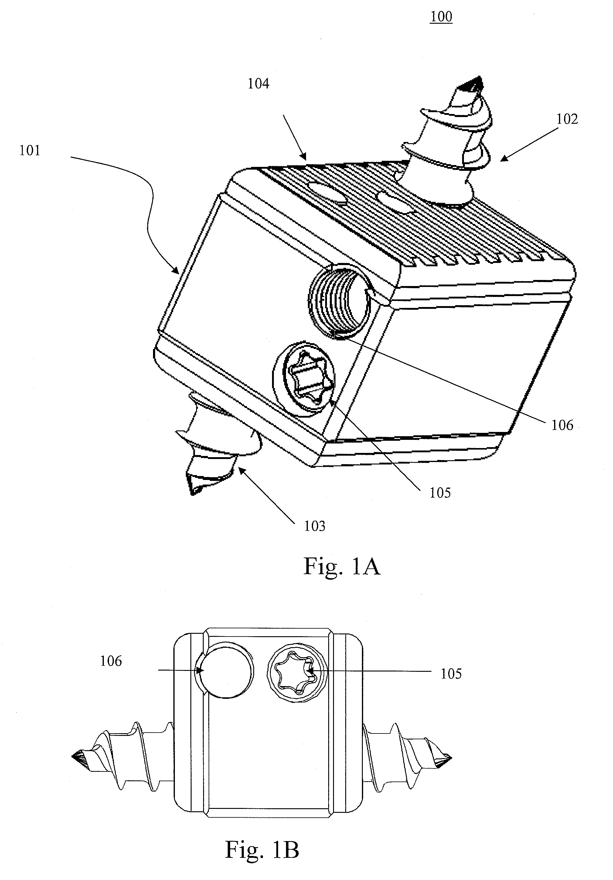 Bi-directional fixating transvertebral body screws, zero-profile horizontal intervertebral miniplates, total intervertebral body fusion devices, and posterior motion-calibrating interarticulating joint stapling device for spinal fusion