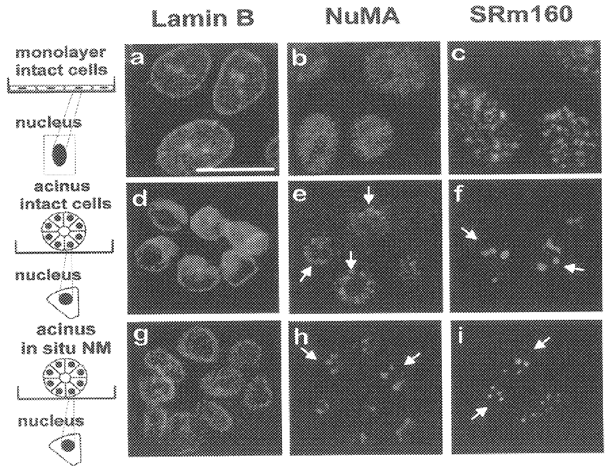 Utilization of nuclear structural proteins for targeted therapy and detection of proliferative and differentiation disorders