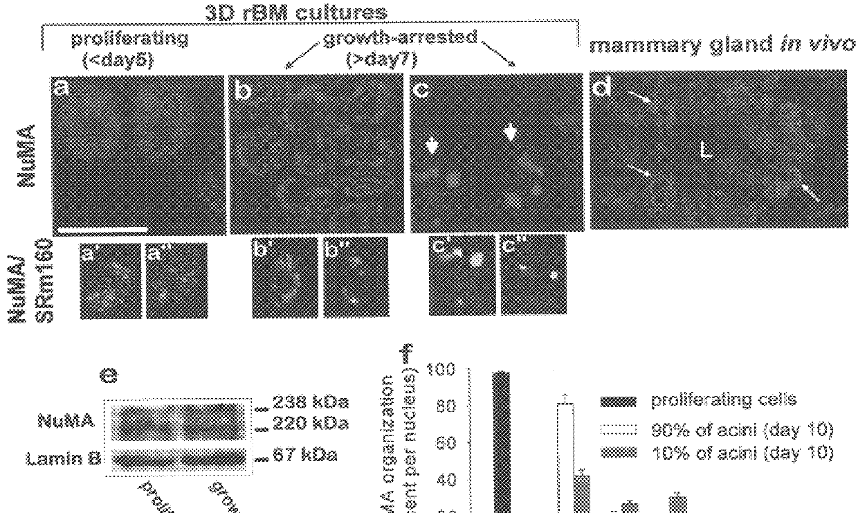 Utilization of nuclear structural proteins for targeted therapy and detection of proliferative and differentiation disorders