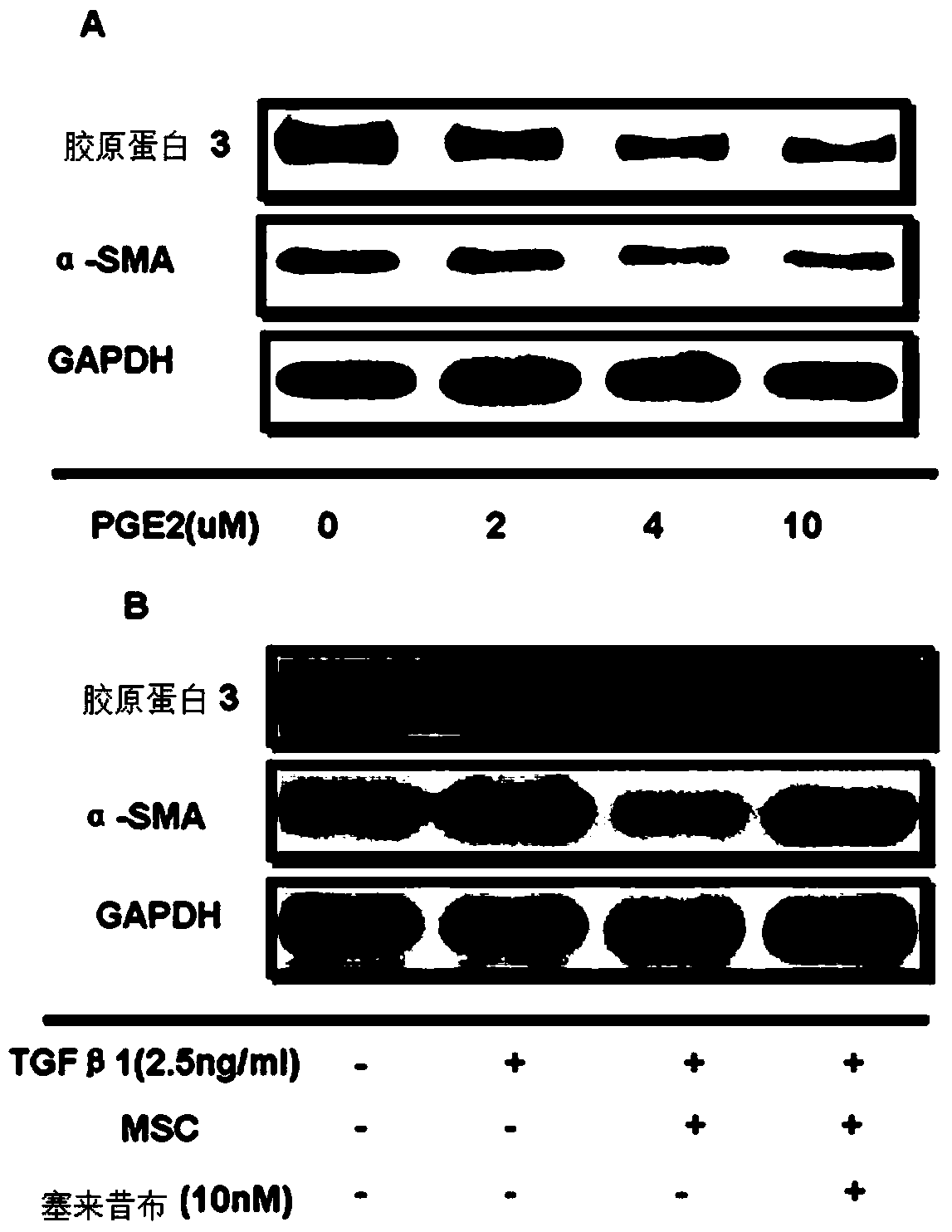 Application of umbilical cord mesenchymal stem cells in the preparation of pharmaceutical preparations for the treatment of pulmonary interstitial fibrosis