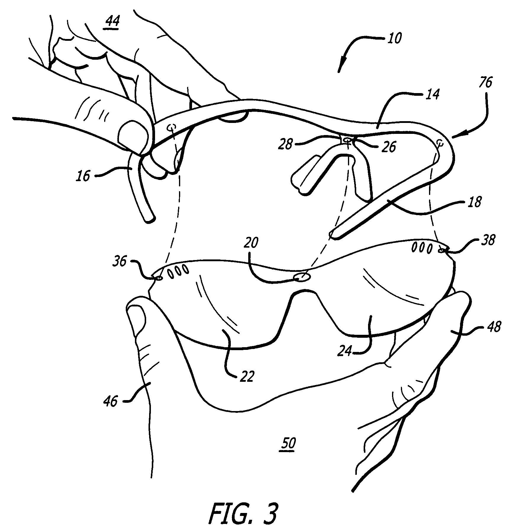 Convertible eyewear