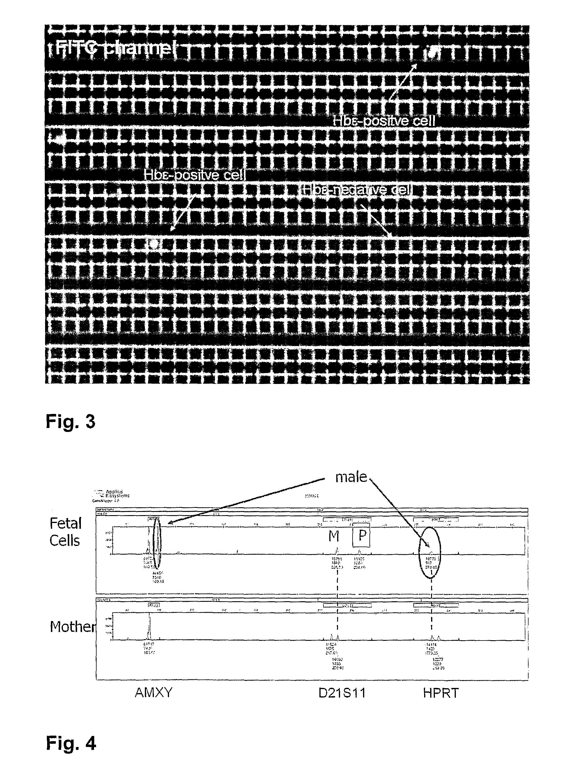 Method and Device for Non-Invasive Prenatal Diagnosis