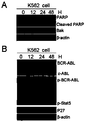 Application of compound hu-17 alone or in combination with tyrosine kinase inhibitors in the preparation of drugs for the treatment of chronic myelogenous leukemia