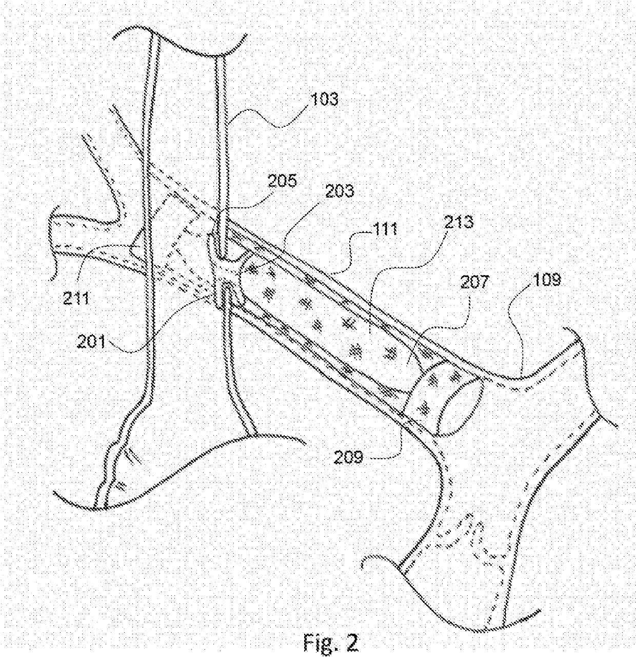 Pulmonary arterial compliance enhancement and control device