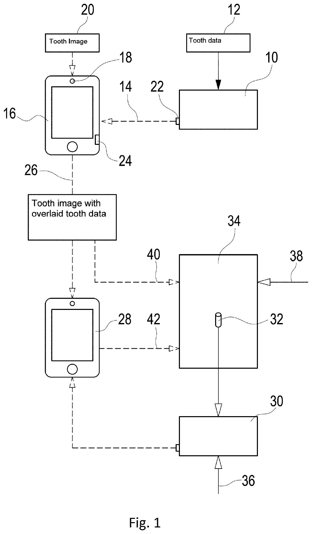 Support system for the manufacture of dental restorations, as well as dental restoration system