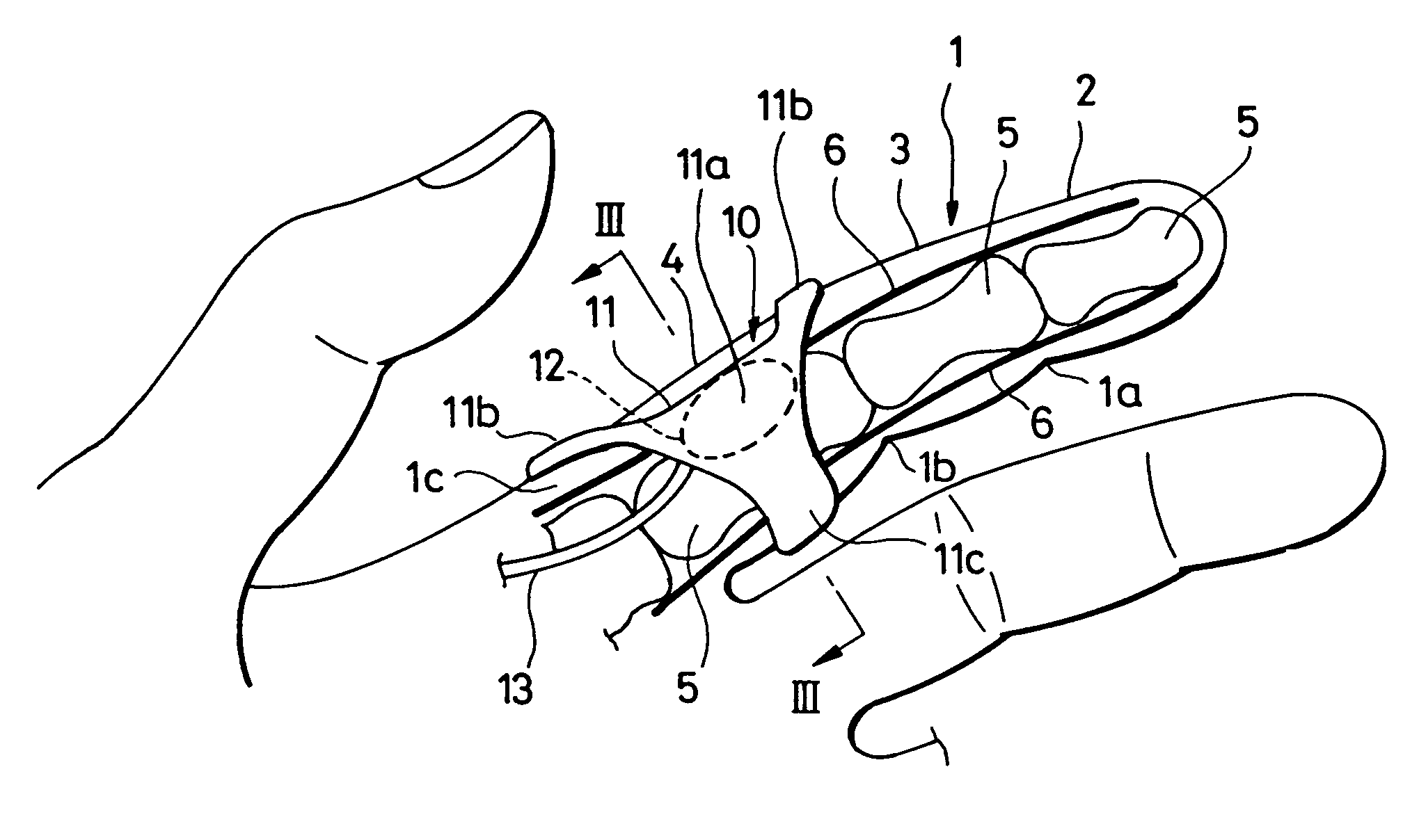 Cuff-block for finger arterial blood pressure monitor