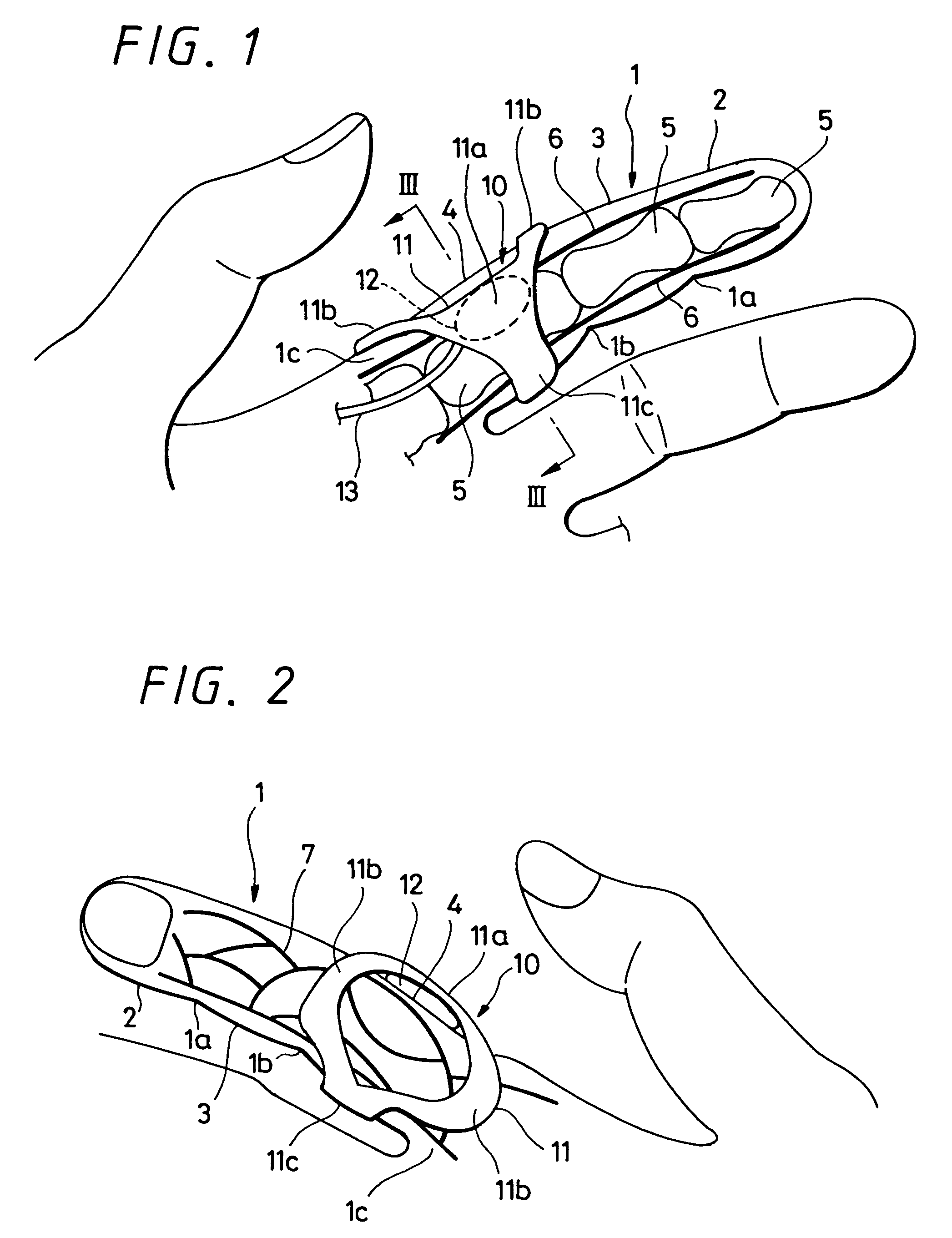 Cuff-block for finger arterial blood pressure monitor