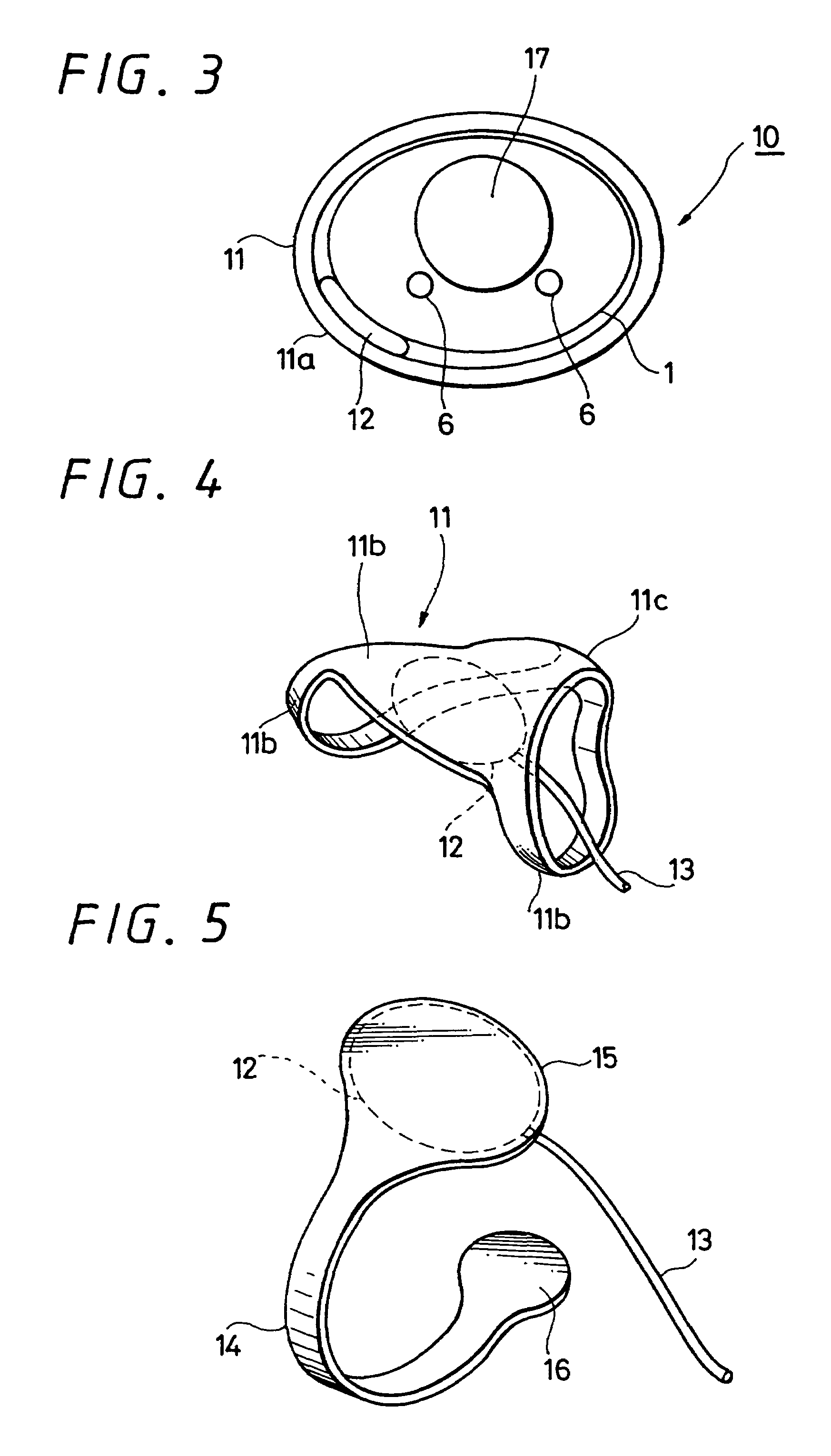 Cuff-block for finger arterial blood pressure monitor