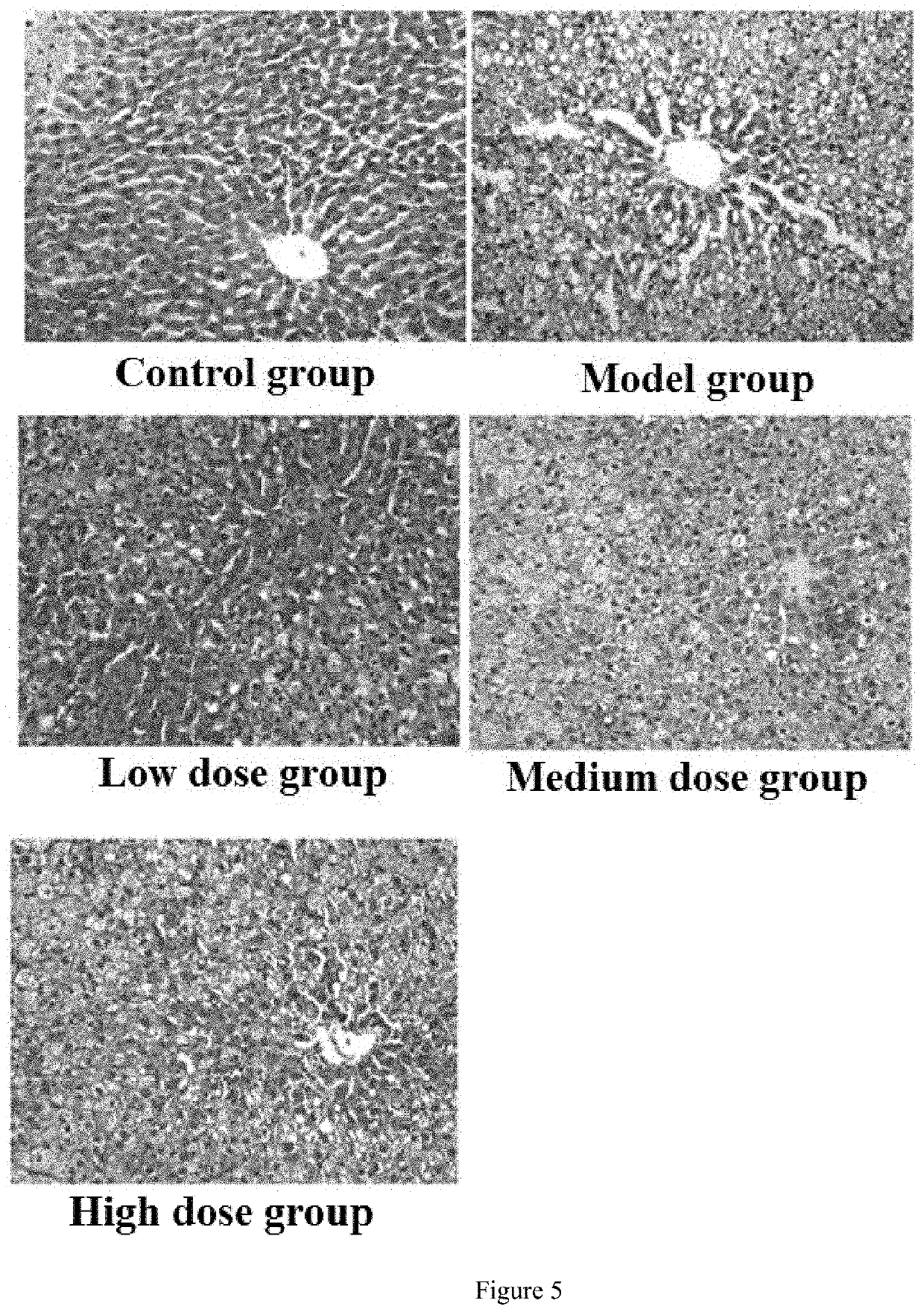 Total flavonoid extract from <i>Gynura formosana </i>Kitam., preparation method thereof, and use of same in treating non-alcoholic fatty liver disease