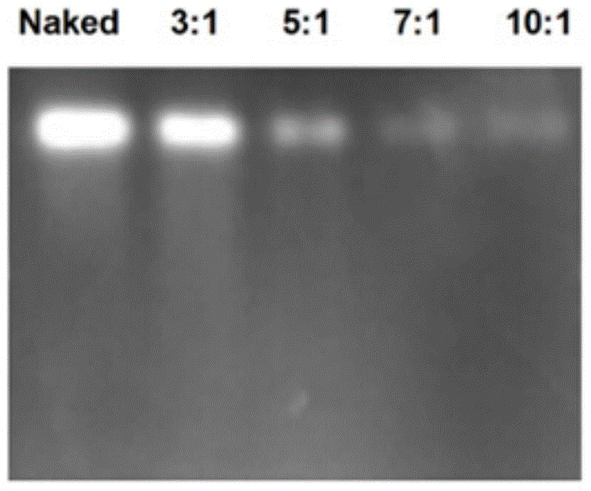 Preparation method of targeting octreotide-modified chitosan molecular beacon nanocomposite for lung cancer diagnosis