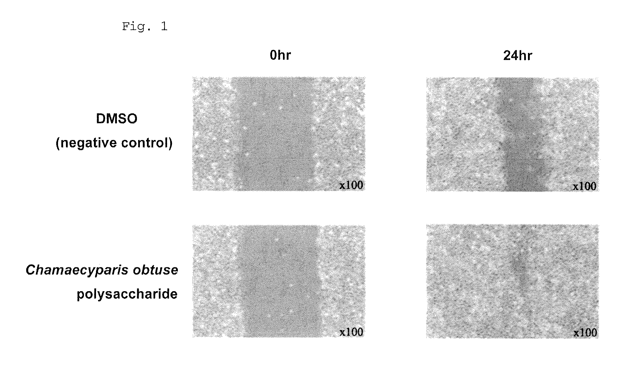 Composition containing chamaecyparis obtusa polysaccharides to be externally applied to the skin