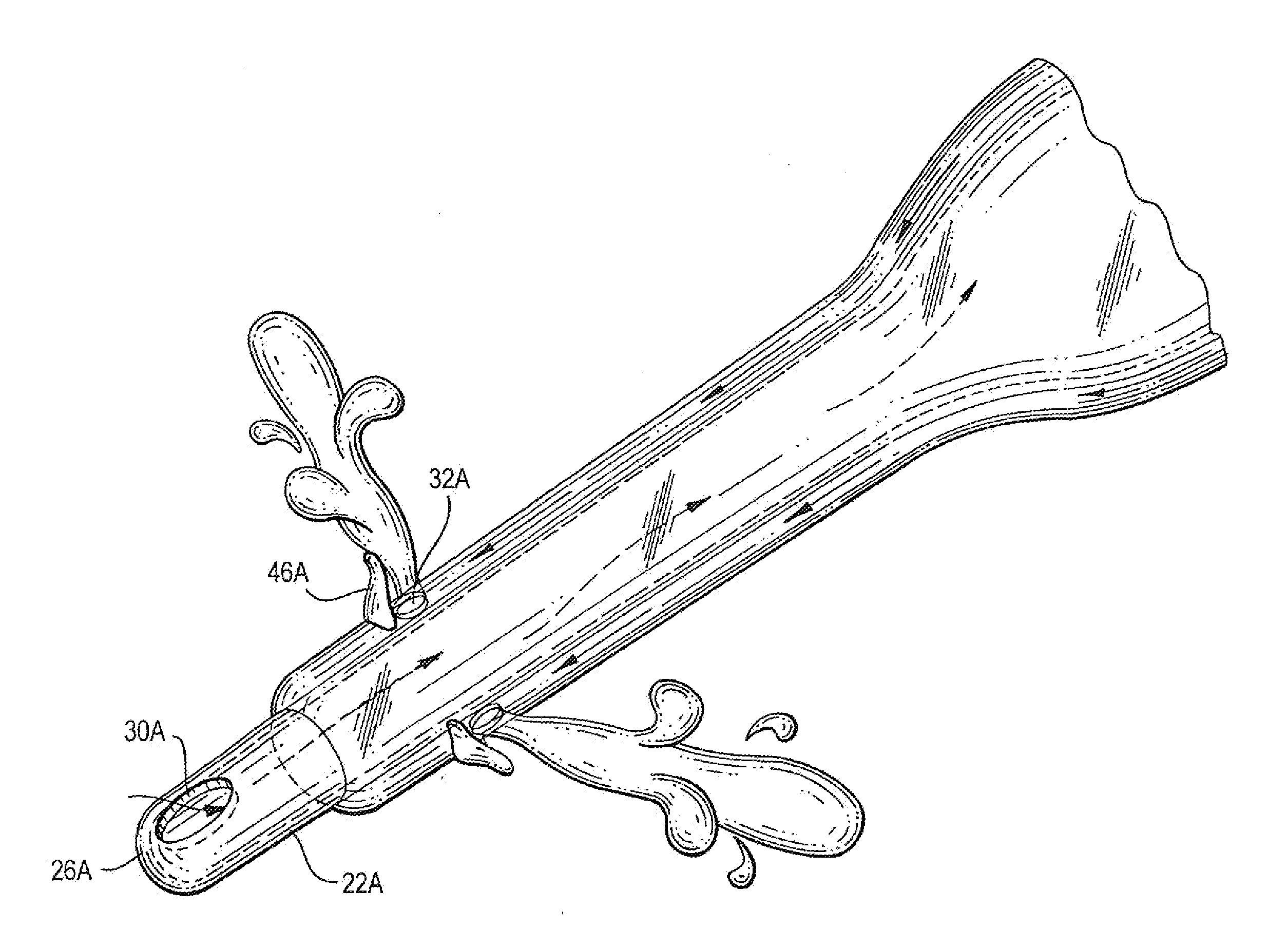 Apparatus and method for performing phacoemulsification