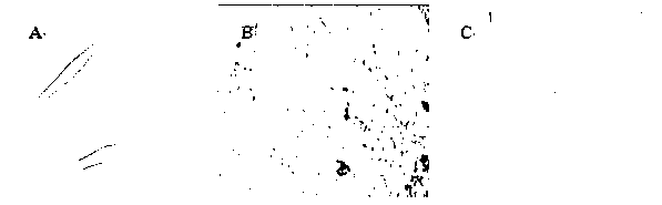 Simple separation and identification method of human placenta myofibroblasts