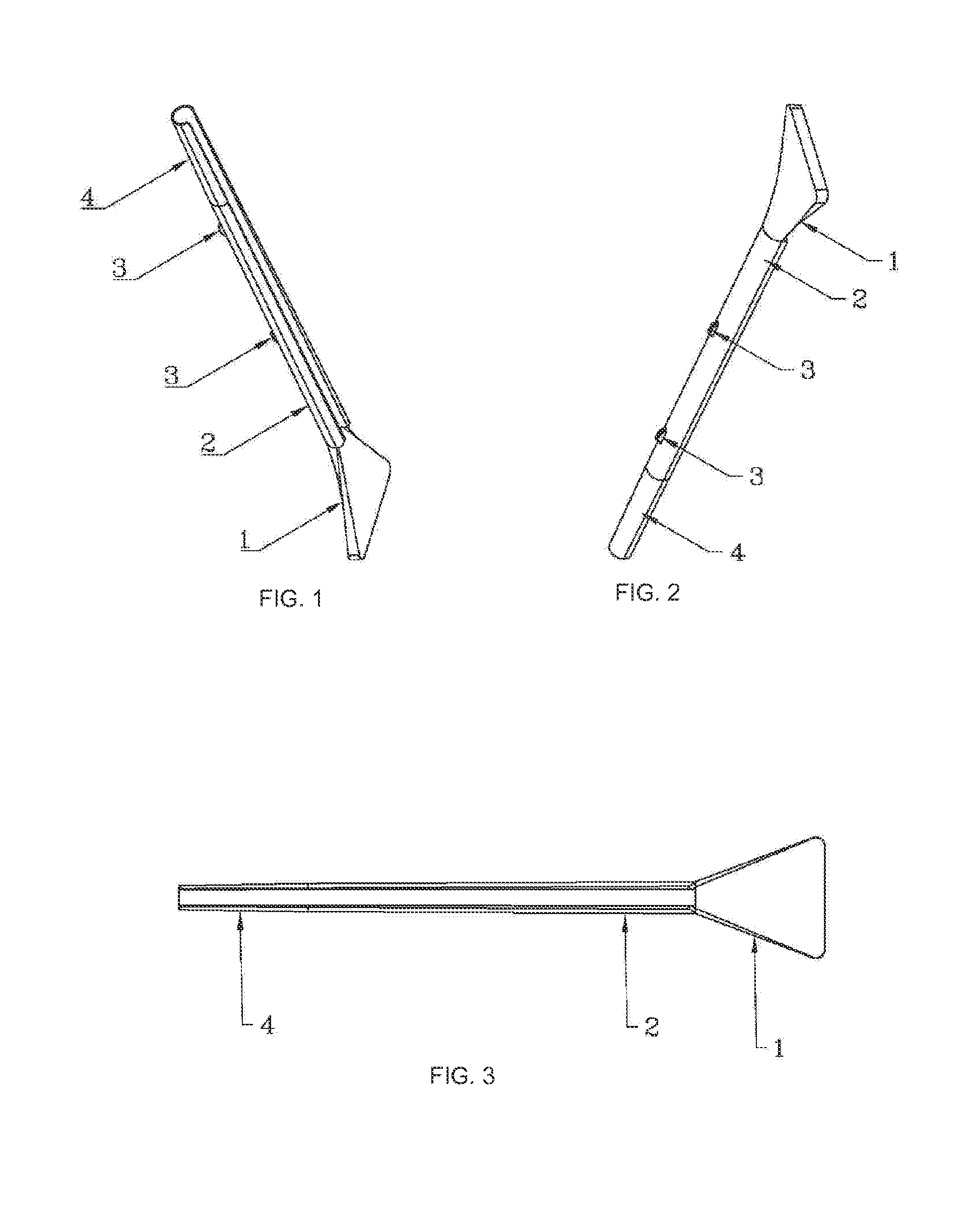 Extravascular protective stent