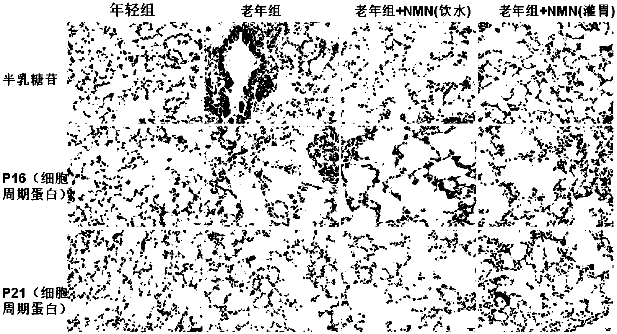 Use of beta-nicotinamide mononucleotide or precursor thereof in preparation of medicament for delaying lung aging