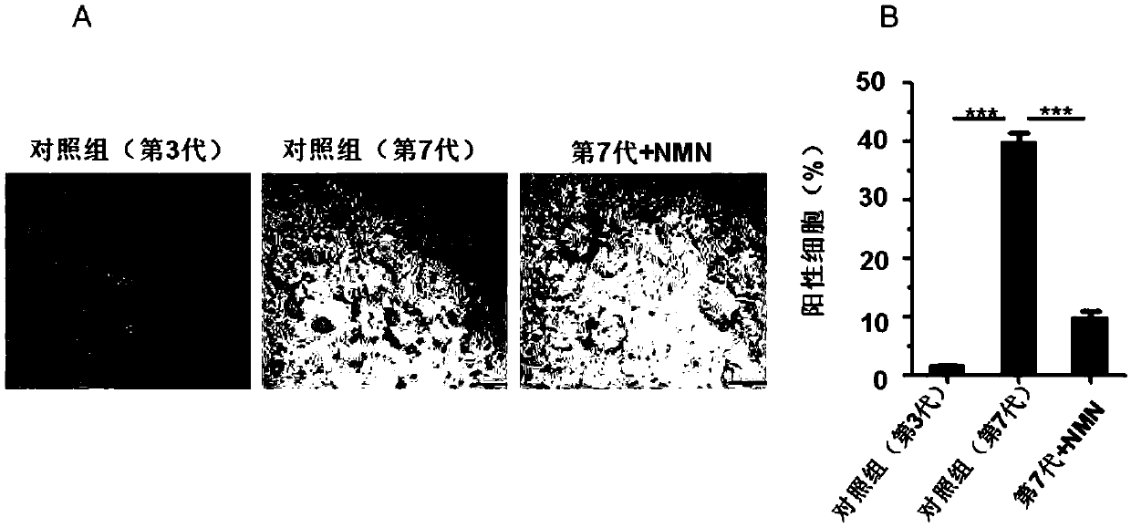 Use of beta-nicotinamide mononucleotide or precursor thereof in preparation of medicament for delaying lung aging