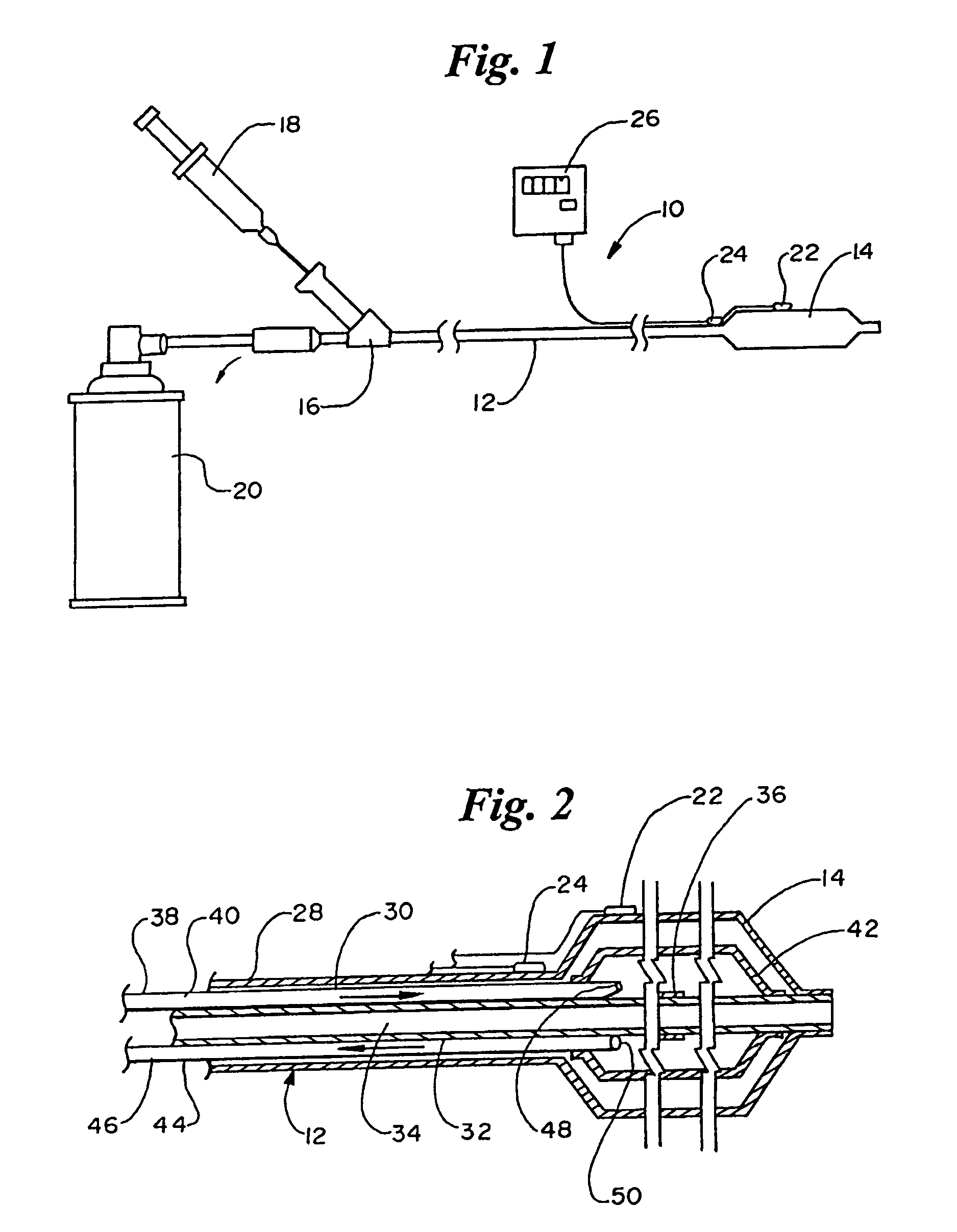 Cryoplasty device and method