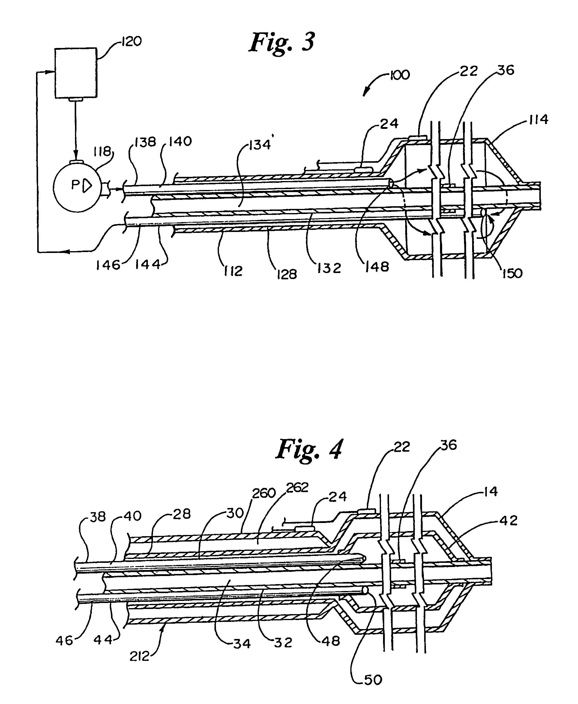 Cryoplasty device and method