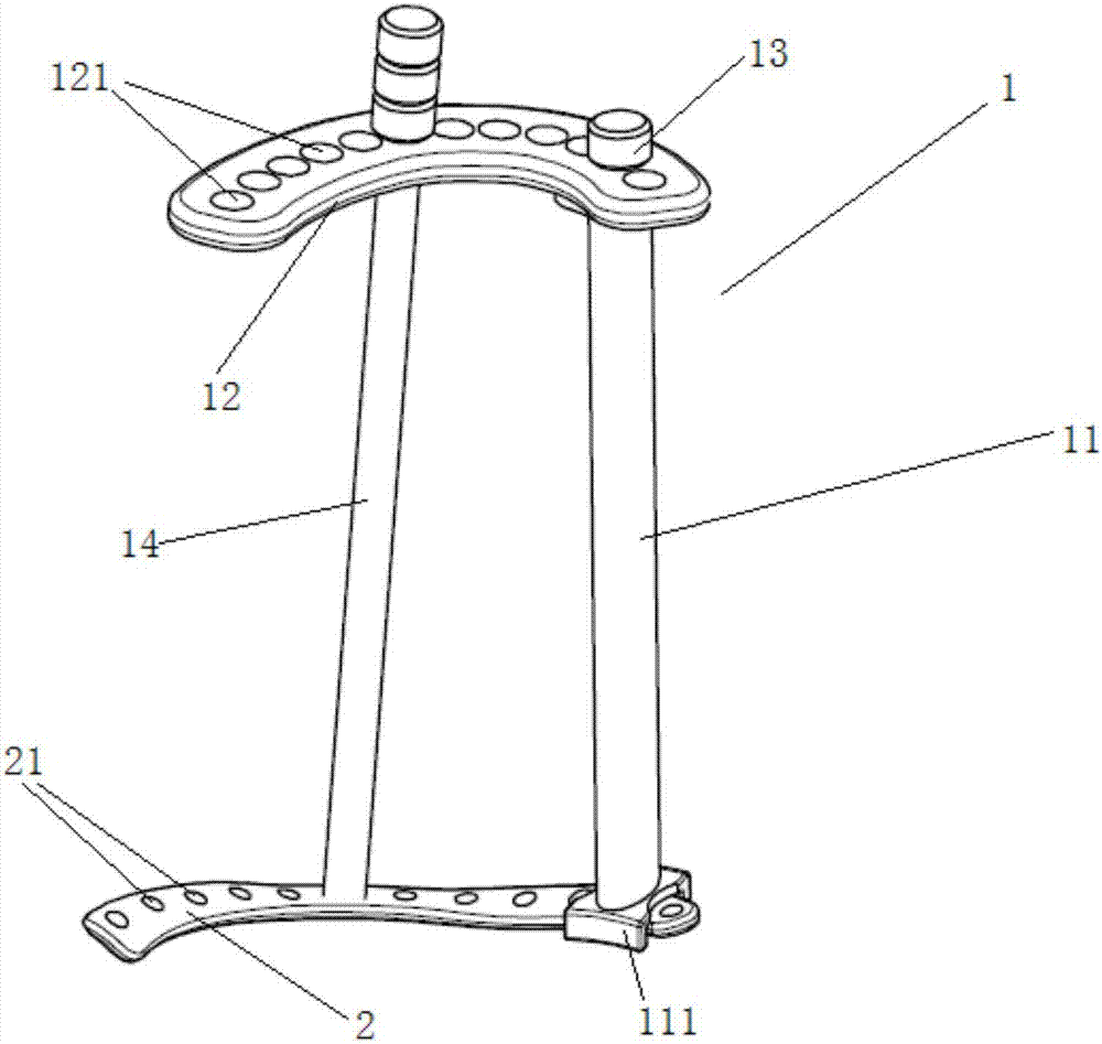 Pelvic locking plate system