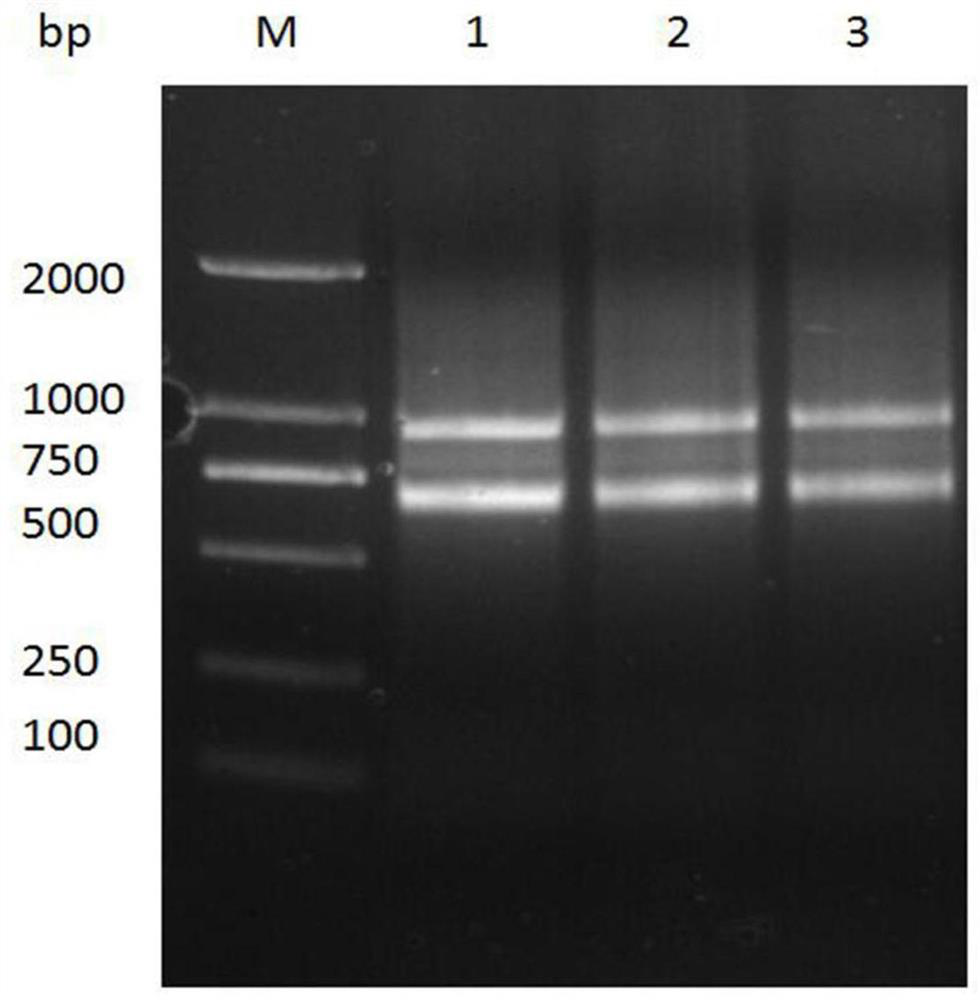 A kind of anti-afp nanobody 2f5 and its application