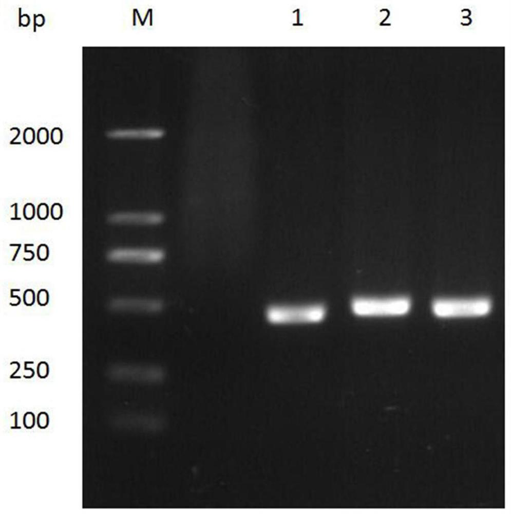 A kind of anti-afp nanobody 2f5 and its application