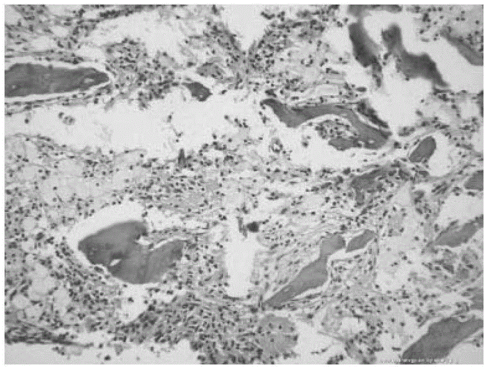 A kind of natural inorganic bone matrix and preparation method thereof